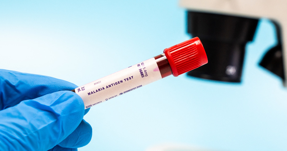 Health Dept says Gauteng malaria cases imported from high-risk areas