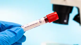 Health Dept says Gauteng malaria cases imported from high-risk areas Health Dept says Gauteng malaria cases imported from high-risk areas