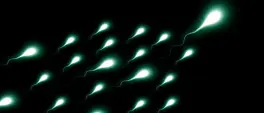 UWC research project calls for sperm donations in bid to better understand male fertility UWC research project calls for sperm donations in bid to better understand male fertility