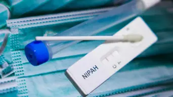 Health Department allays fears amid Nipah virus outbreak concerns Health Department allays fears amid Nipah virus outbreak concerns