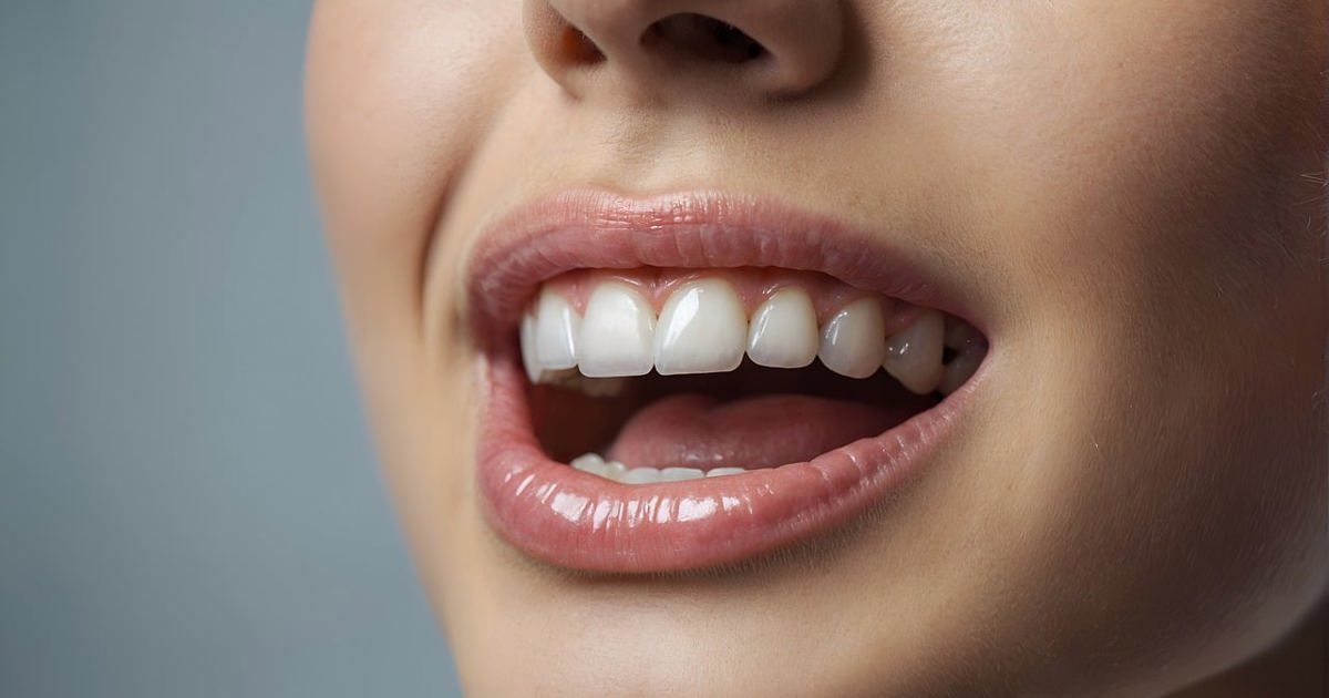 Slathering Teeth How to spot, stop, and survive teeth grinding: 'It's a destructive habit'