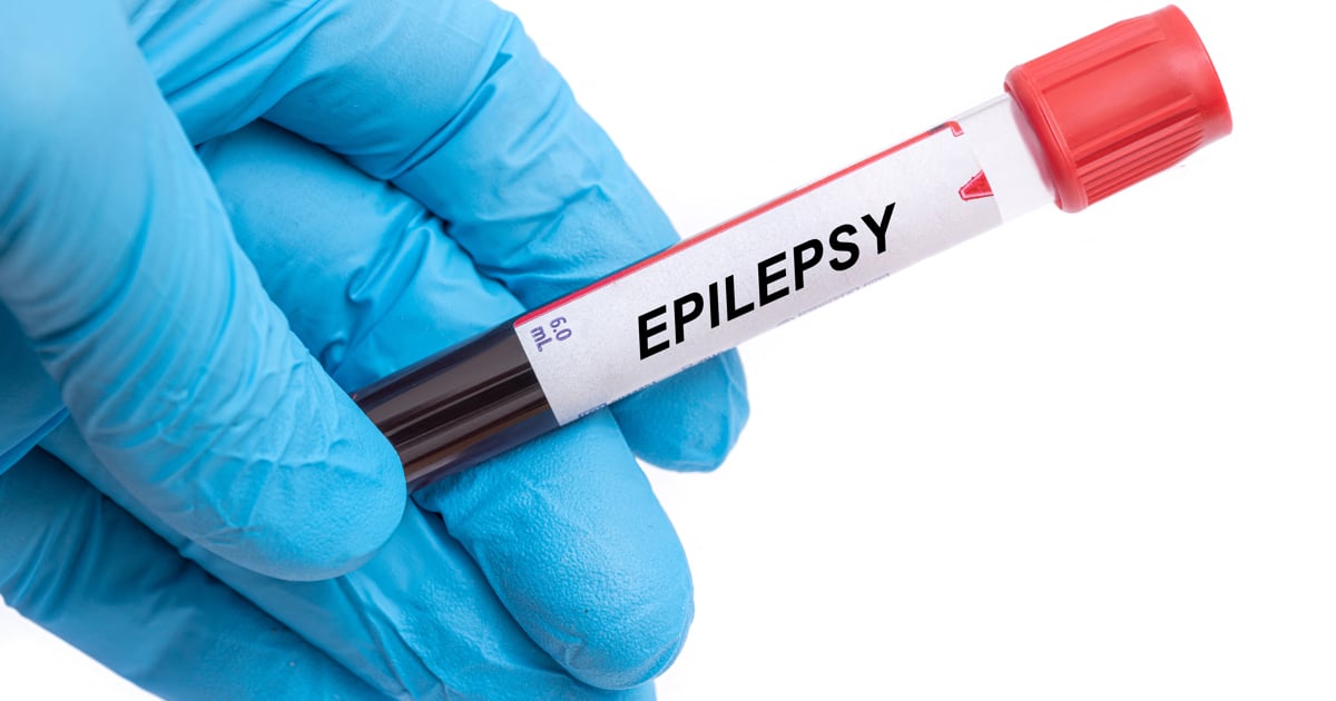 Epilepsy SA calls for public awareness to tackle demonic possession myths