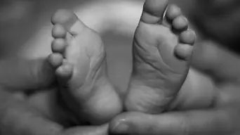 One of conjoined twins separated in historic surgery in Limpopo passes away One of conjoined twins separated in historic surgery in Limpopo passes away