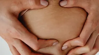 Stretch marks cannot be reversed. Here’s how to make them less visible Stretch marks cannot be reversed. Here’s how to make them less visible