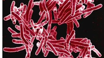 170 people die of TB every day in SA, reveals Health Dept 170 people die of TB every day in SA, reveals Health Dept