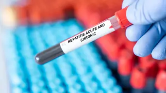 Hepatitis viruses kill 3,500 people a day: WHO Hepatitis viruses kill 3,500 people a day: WHO