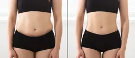 Struggling to lose or keep off weight? Here’s the truth about Ozempic Struggling to lose or keep off weight? Here’s the truth about Ozempic
