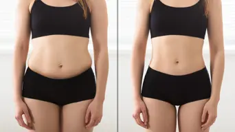 Struggling to lose or keep off weight? Here’s the truth about Ozempic Struggling to lose or keep off weight? Here’s the truth about Ozempic
