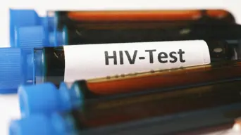 Women aged 15-24 have highest weekly HIV & TB infections in SA Women aged 15-24 have highest weekly HIV & TB infections in SA