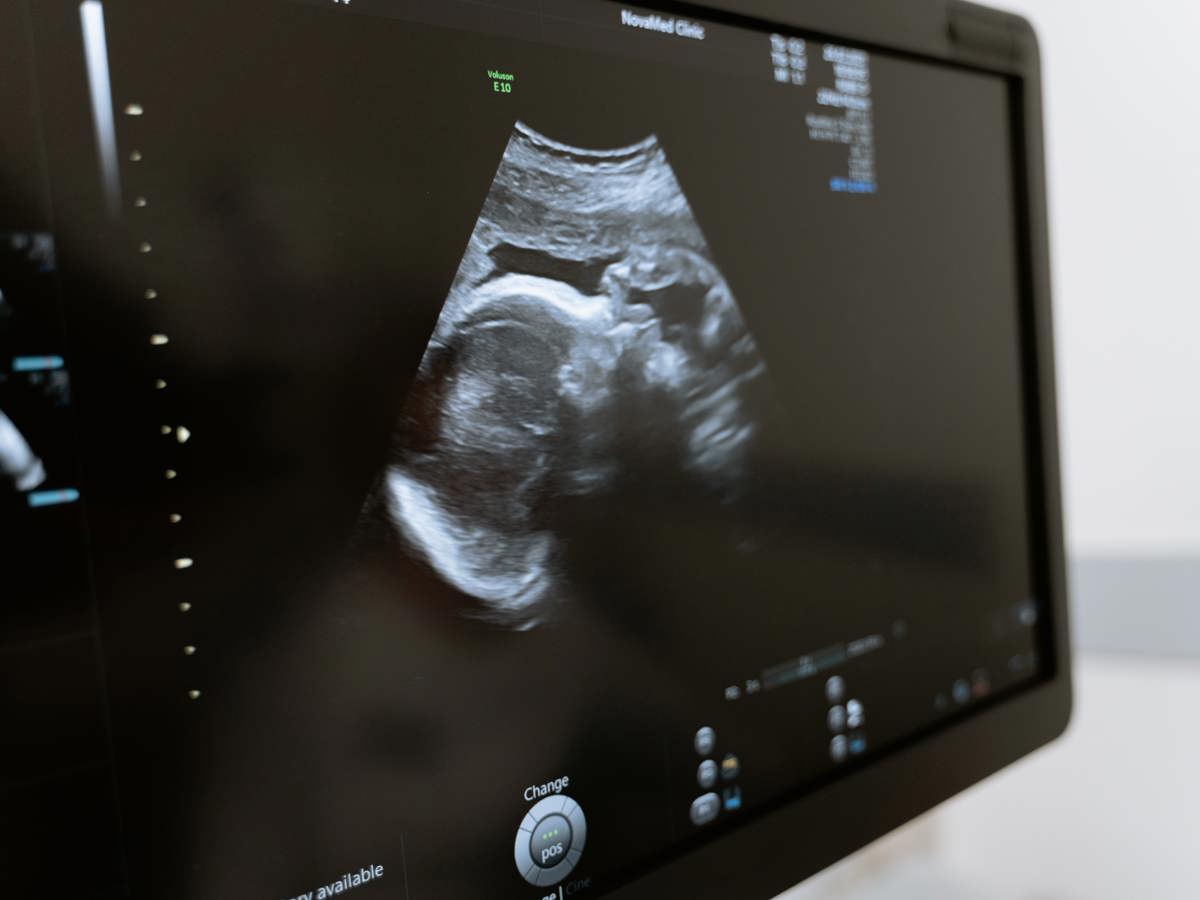City of Cape Town to observe Pregnancy Week from 12-16 February - Vimarsana News