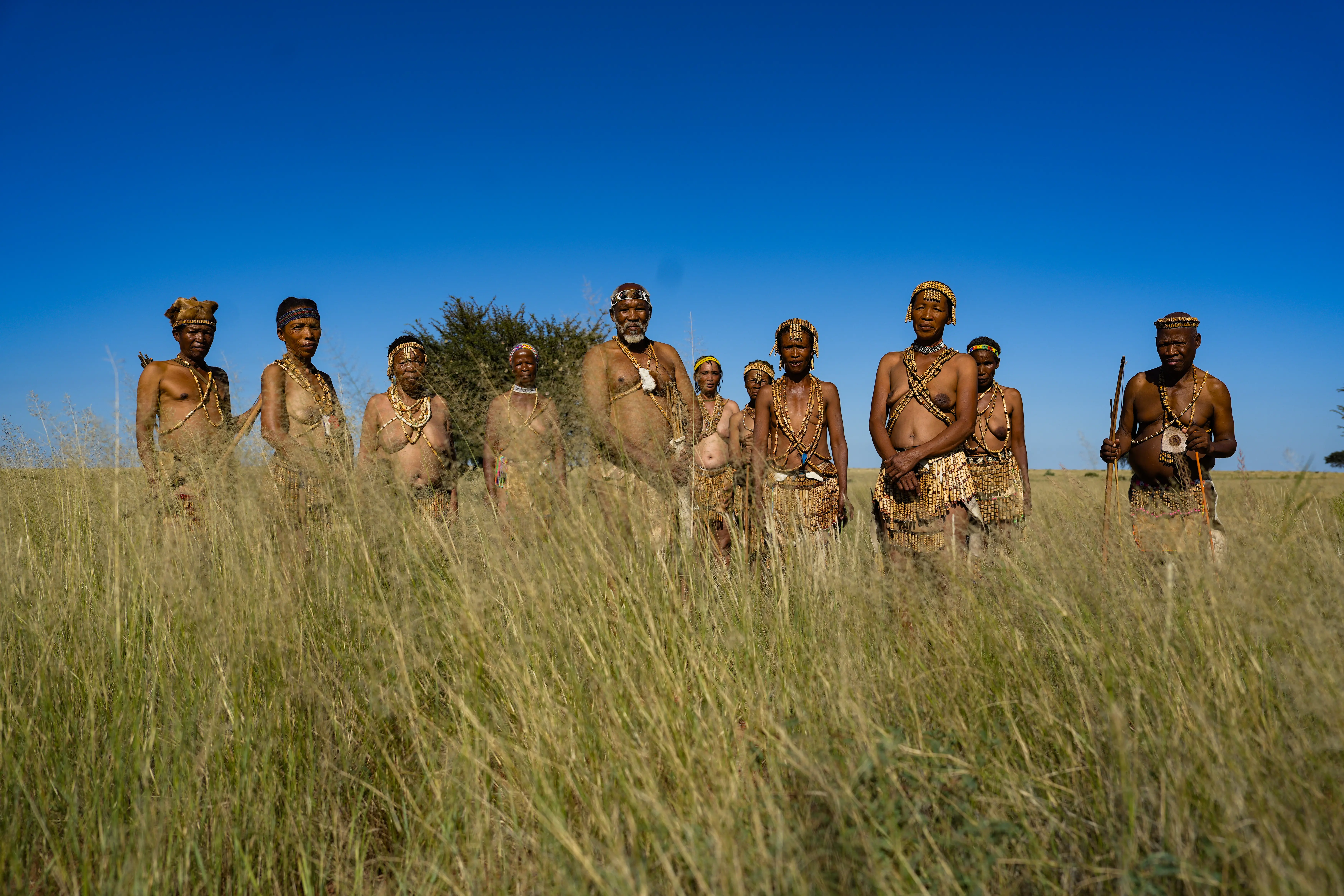 The !Xun San of Platfontein say despite being in the country since 1990, they still get called immigrants. Picture: Kayleen Morgan/Eyewitness News The !Xun San of Platfontein say despite being in the country since 1990, they still get called immigrants. Picture: Kayleen Morgan/Eyewitness News