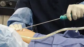 Healing from botched cosmetic surgery: Michelle Roniak's quest for the ideal body and her battle for survival Healing from botched cosmetic surgery: Michelle Roniak's quest for the ideal body and her battle for survival